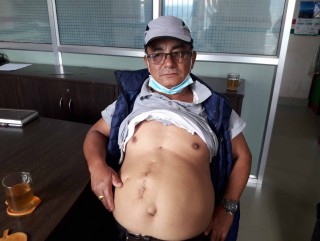 जसले सामन्त विरुद्ध लड्दा १६ वर्षकै उमेरमा गोली खाए...