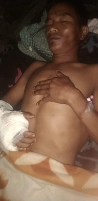 कोईला काट्नेक्रममा तालले थिचिँदा गम्भीर घाईते, आर्थिक अभावमा उपचार हुन सकेन