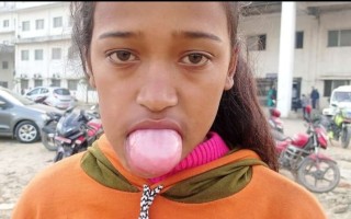 जिब्रो सुन्निएर मुख बाहिर निस्किएपछि बालिकाको बेहाल