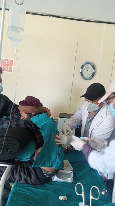 फेमिली केयरमा थोराकोसिन्थेसिस गरेर छातीमा जमेको पिप निकालियो