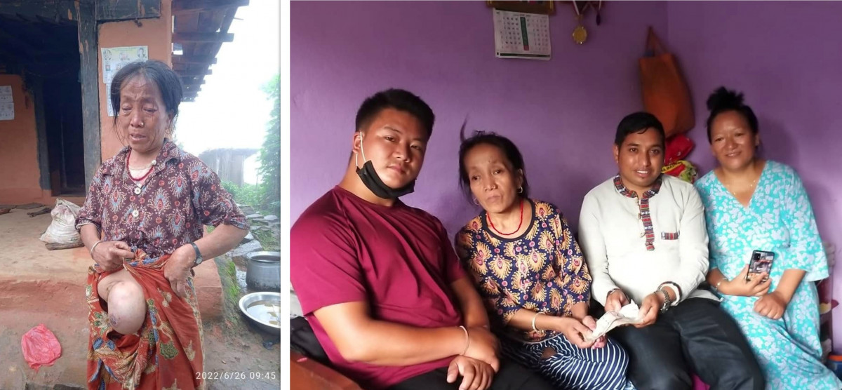 पाठेघर सम्वन्धी समस्याले पीडित बनेकी राईलाई आर्थिक सहयोग