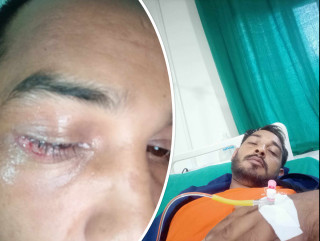 रामकुमारको टाउकोमा पानी जम्ने समस्या, आर्थिक अभावमा उपचार अड्कियो
